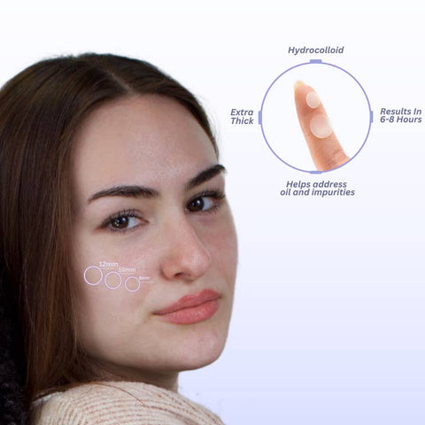 Hydrocolloid Acne Patches – Overnight Blemish Treatment - Skin Care - MaskerAide